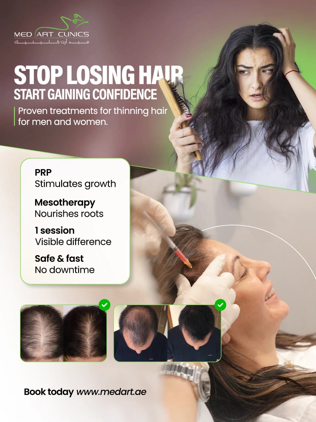 Aesthetic & Dental Clinics social media post: Hair loss PRP and mesotherapy treatment promo.